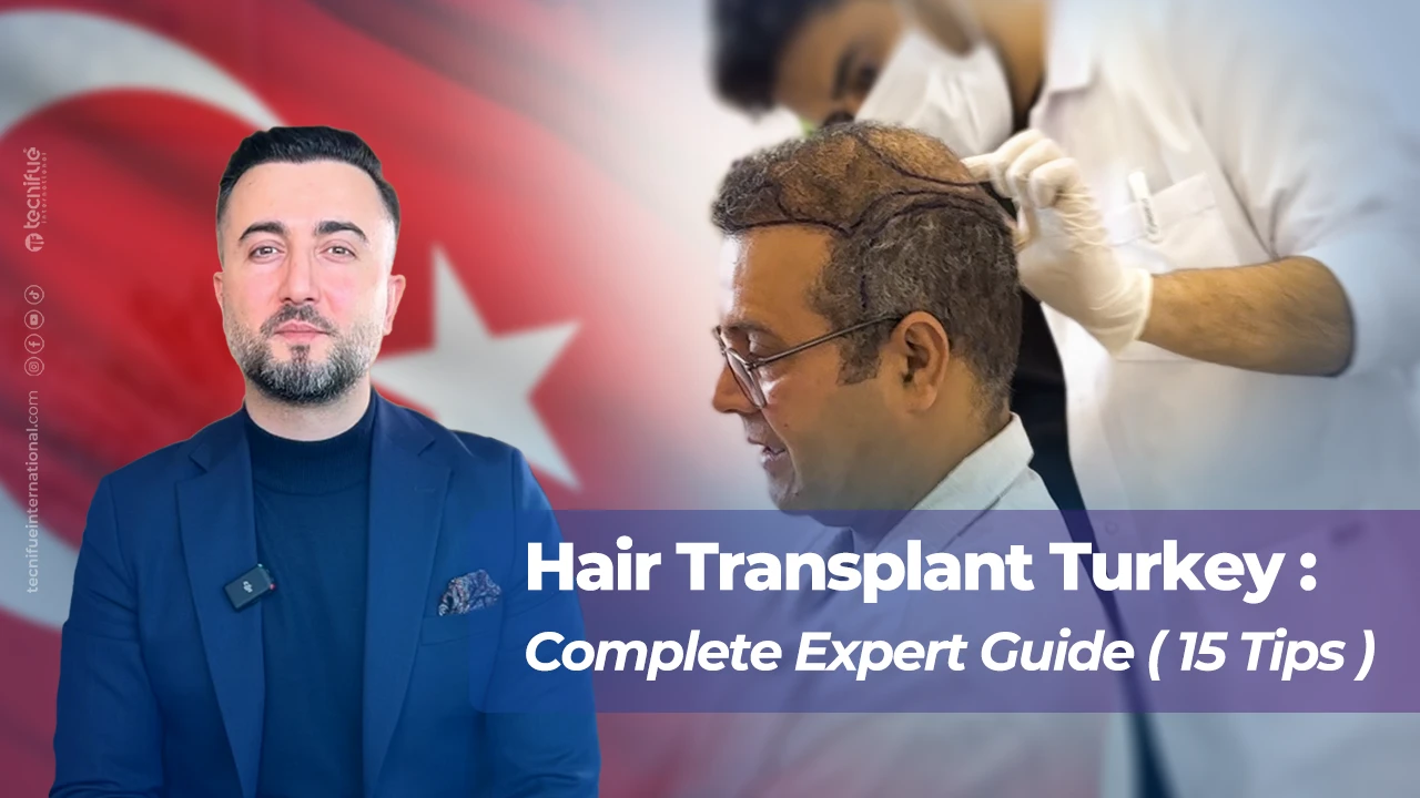 Hair Transplant in Turkey Guide