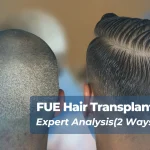 FUE Hair Transplant Scar Blog Cover Blog Tecnifue International