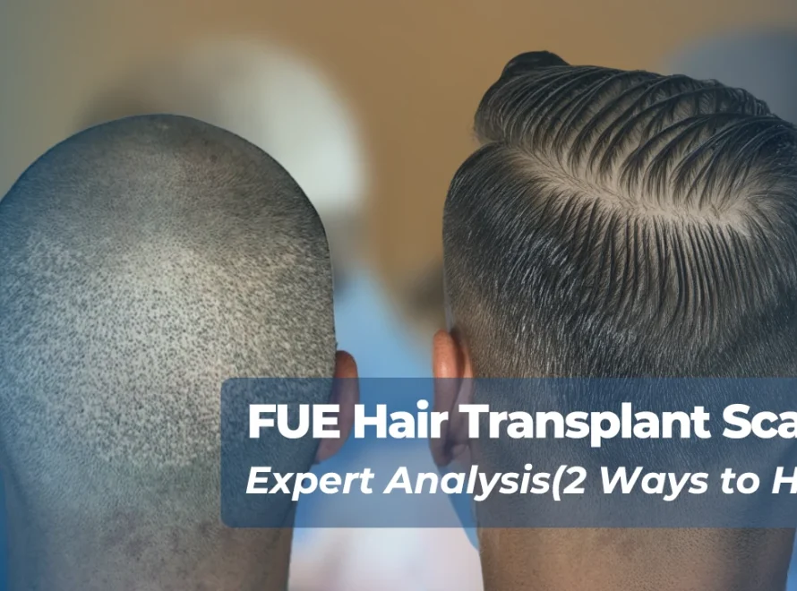 FUE Hair Transplant Scar Blog Cover Blog Tecnifue International