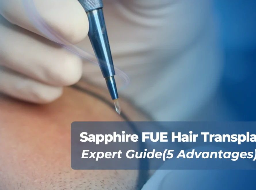 Sapphire FUE Hair Transplant tool holding FUE Sapphire at the tip.