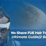 No Shave Fue Hair Transplant
