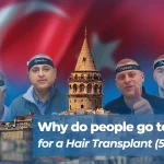 Why do People go to turkey for a Hair Transplant