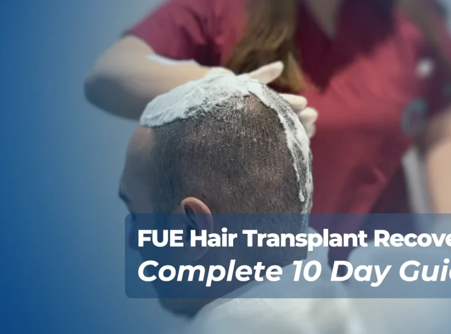 FUE Hair Transplant Recovery Day 10