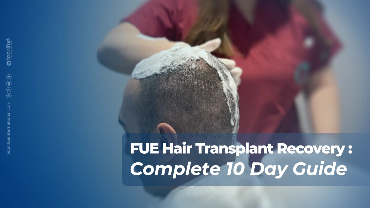 FUE Hair Transplant Recovery Day 10