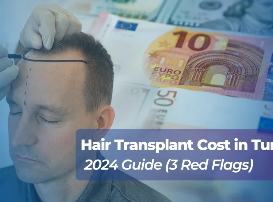 Hair Transplant Cost in Turkey