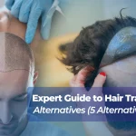 Hair Transplant Alternatives