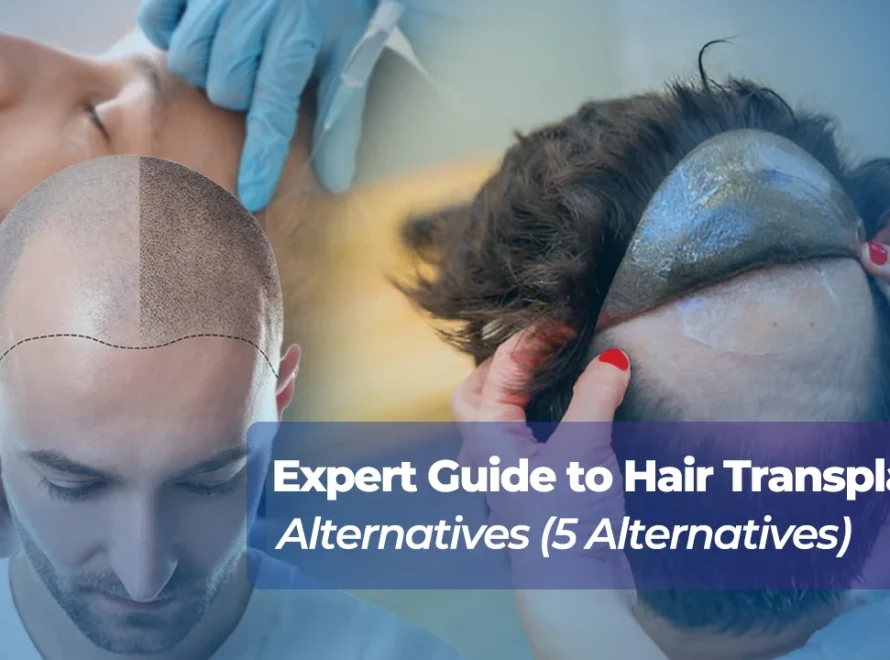 Hair Transplant Alternatives