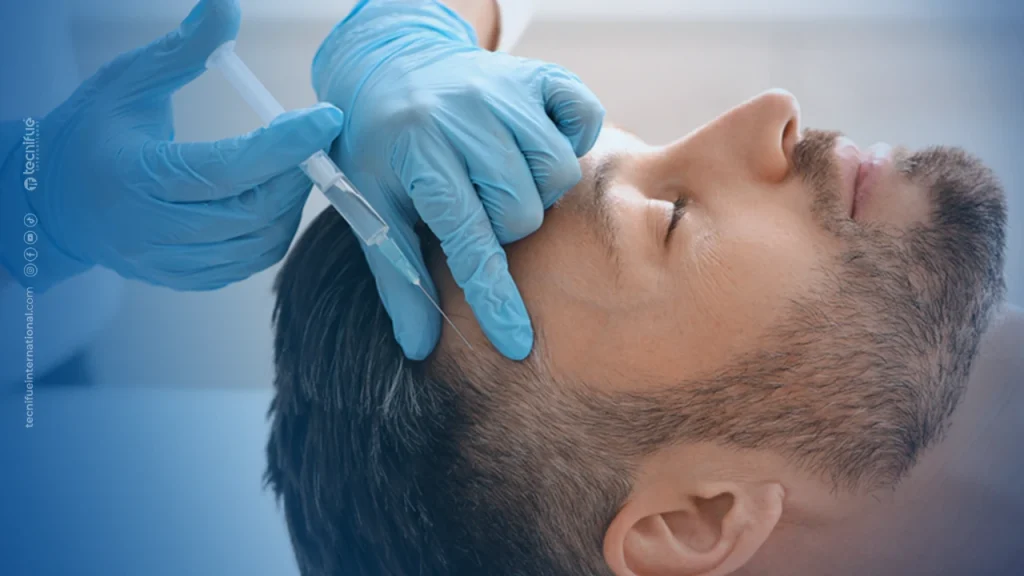 PRP for thicker hair