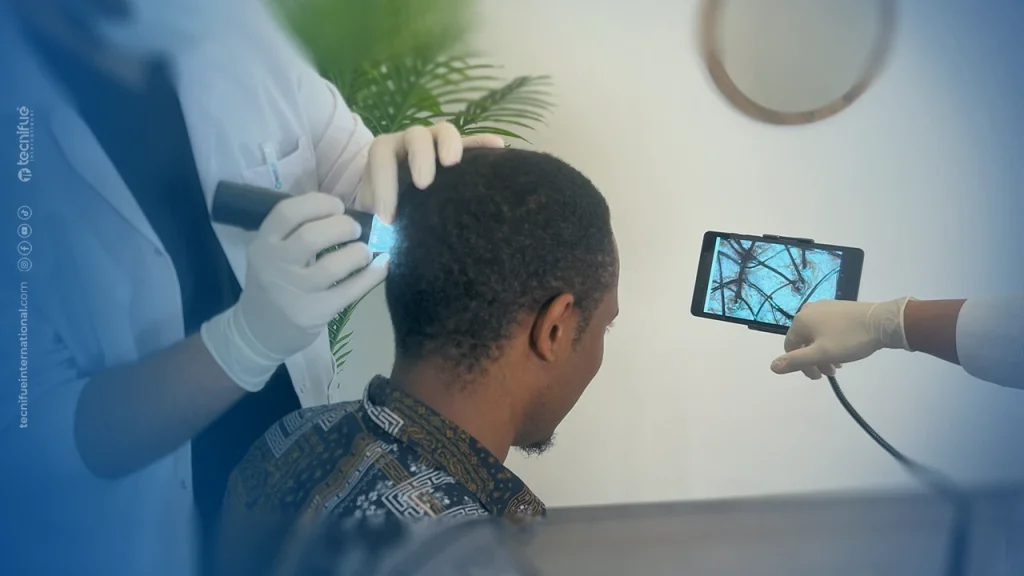 Greffe de Cheveux Afro