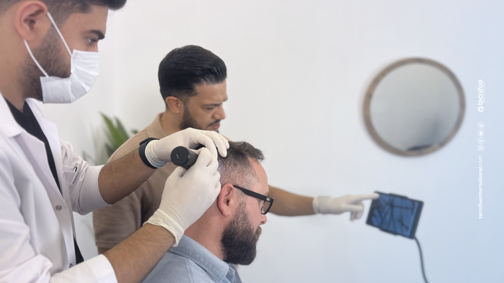 Consultation Greffe de Cheveux 