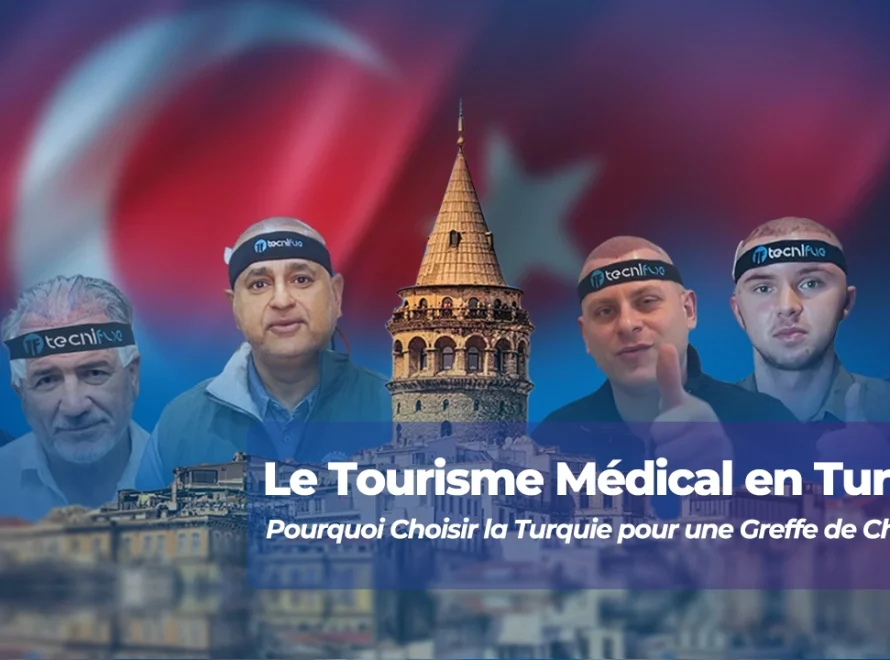 Le Tourisme Médical en Turquie : Pourquoi Choisir la Turquie pour une Greffe de Cheveux ?