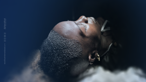 Greffe de Cheveux Afro en Turquie