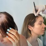 Greffe de cheveux pour Femme