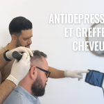 Antidépresseurs et Greffe de Cheveux Cover