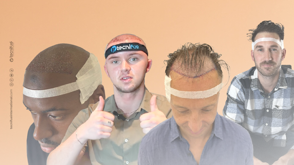 combien de cheveux sur une tête 