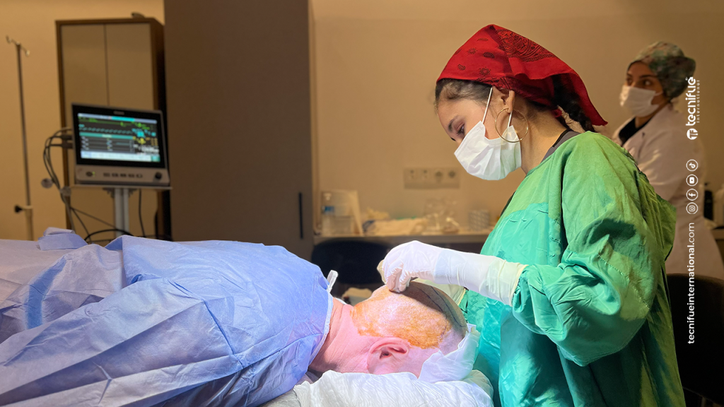 FUE Hair Transplant Turkey