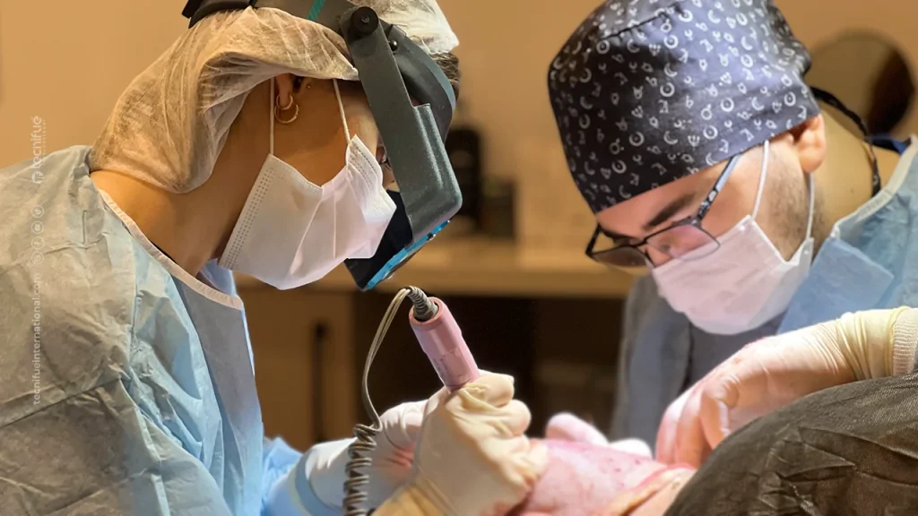 Female FUE Hair Transplant