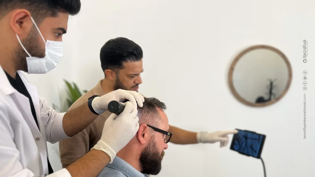 FUe hair consultation