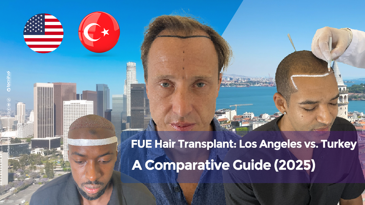 FUE Hair Transplant in Los Angeles Cover