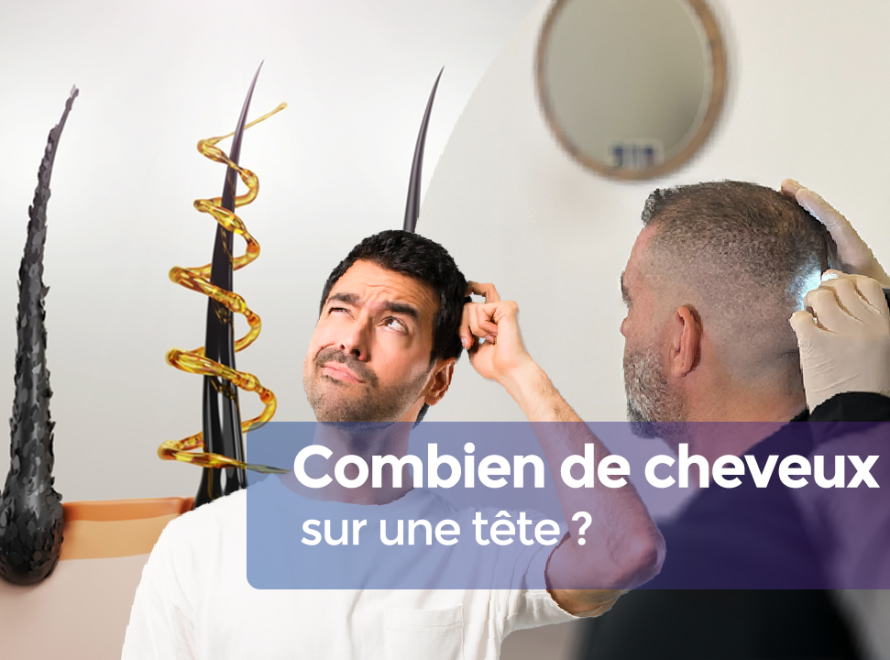 combien de cheveux sur une tête cover