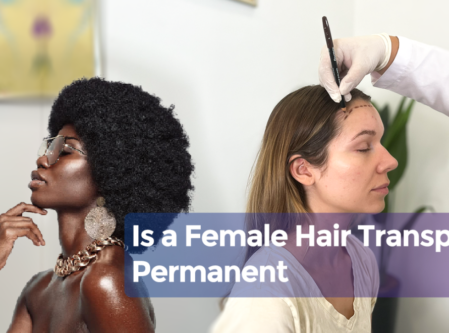 Is a Female Hair Transplant Permanent cover