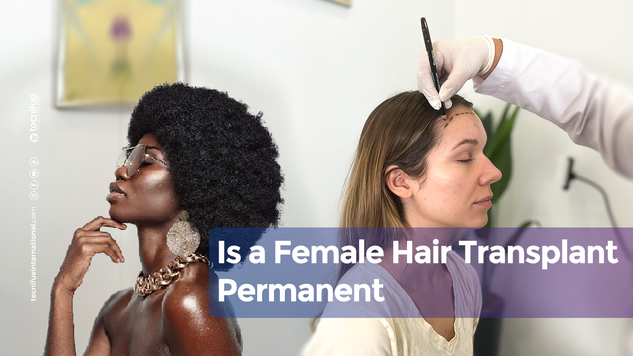 Is a Female Hair Transplant Permanent cover