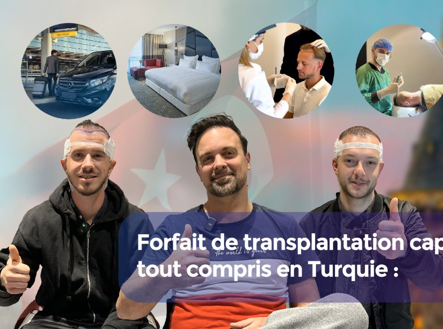 Forfait de transplantation capillaire tout compris en Turquie