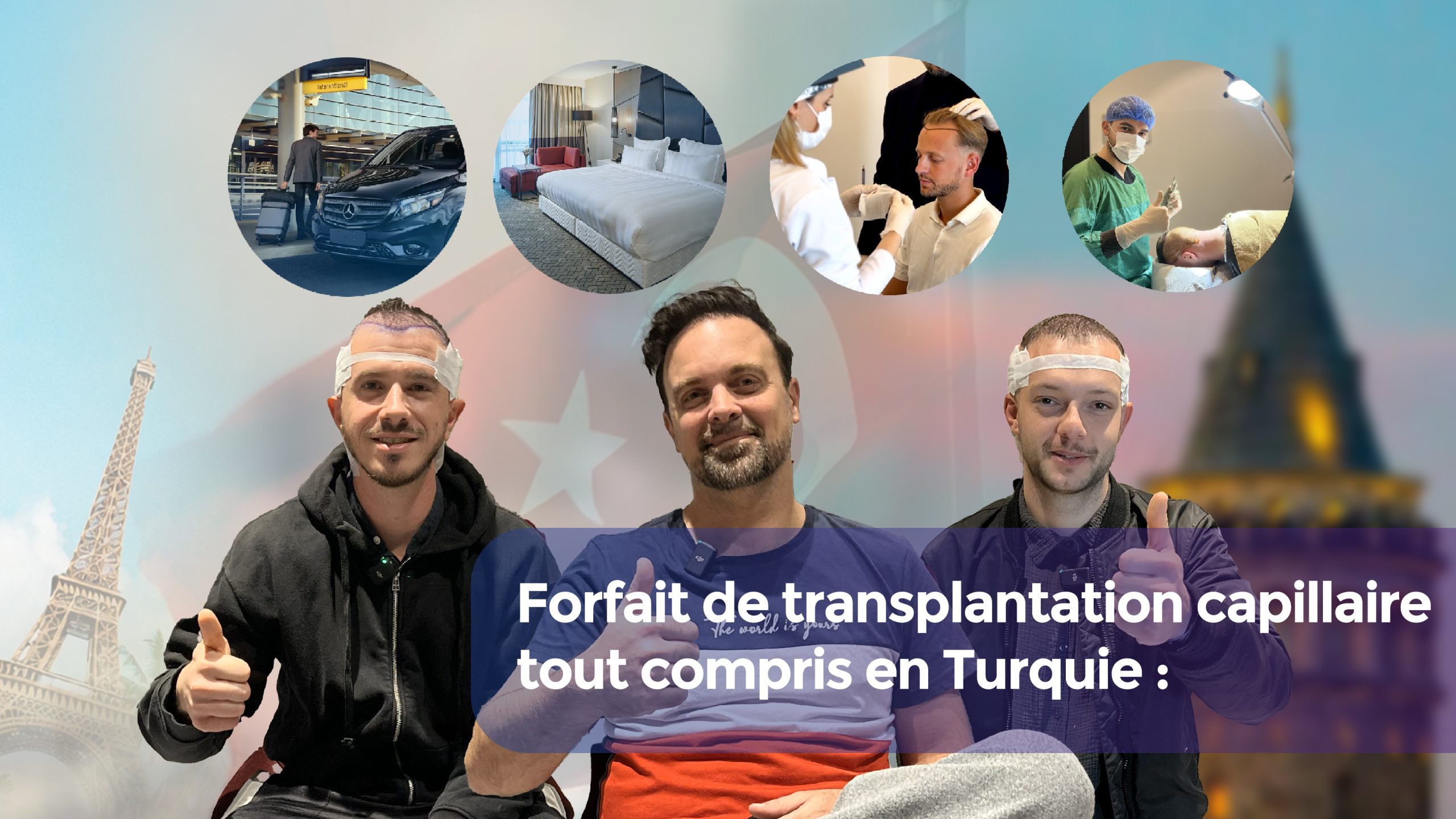 Forfait de transplantation capillaire tout compris en Turquie