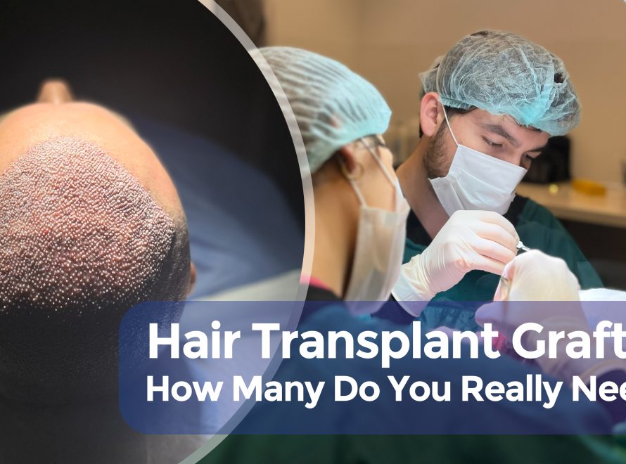 Cover Hair Transplant Grafts