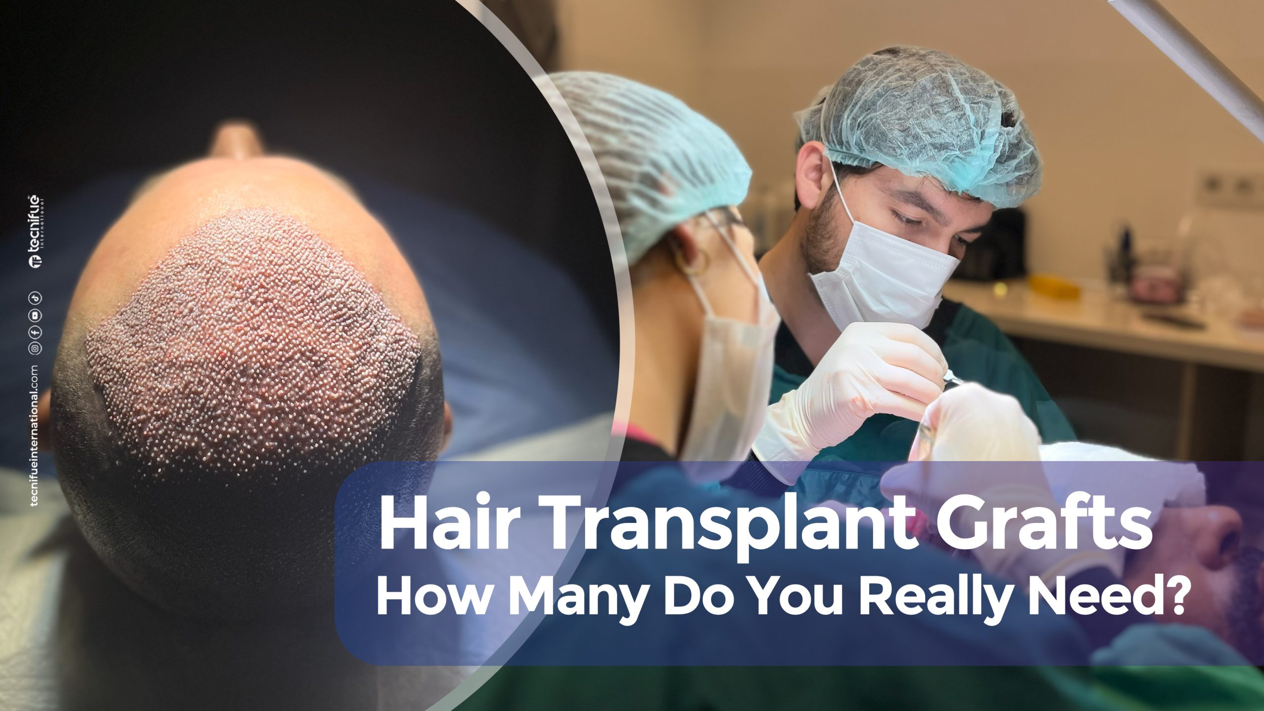 Cover Hair Transplant Grafts