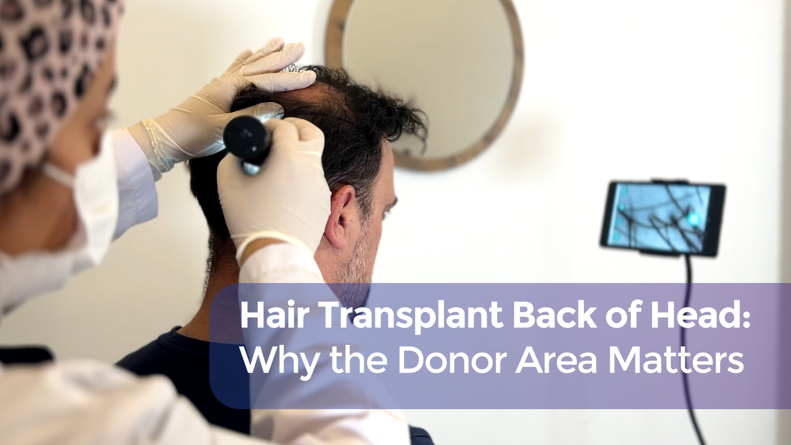 hair transplant back of head cover