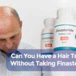 hair transplant without finasteride cover