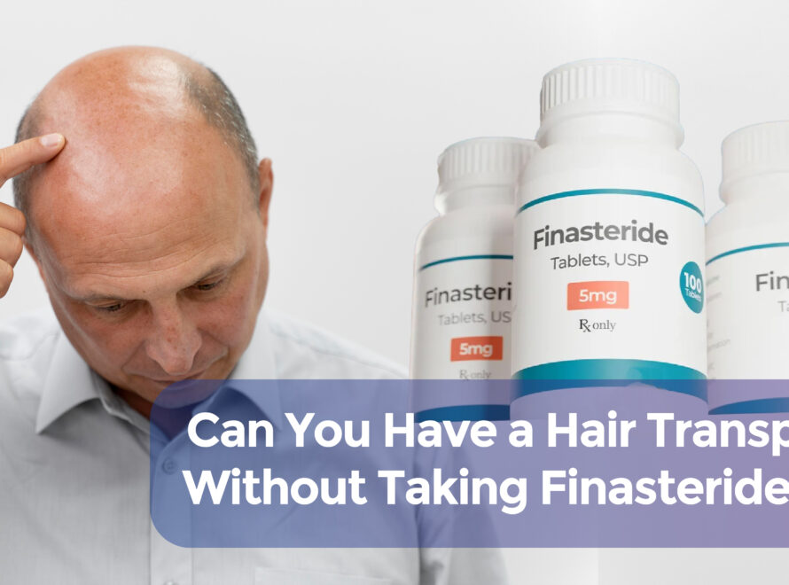 hair transplant without finasteride cover