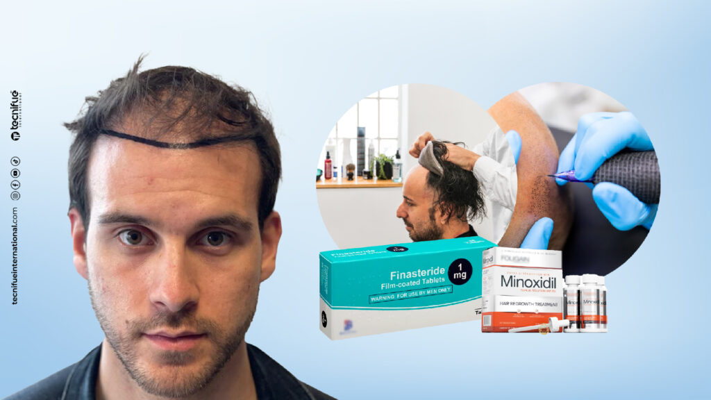 how much does a hair transplant cost