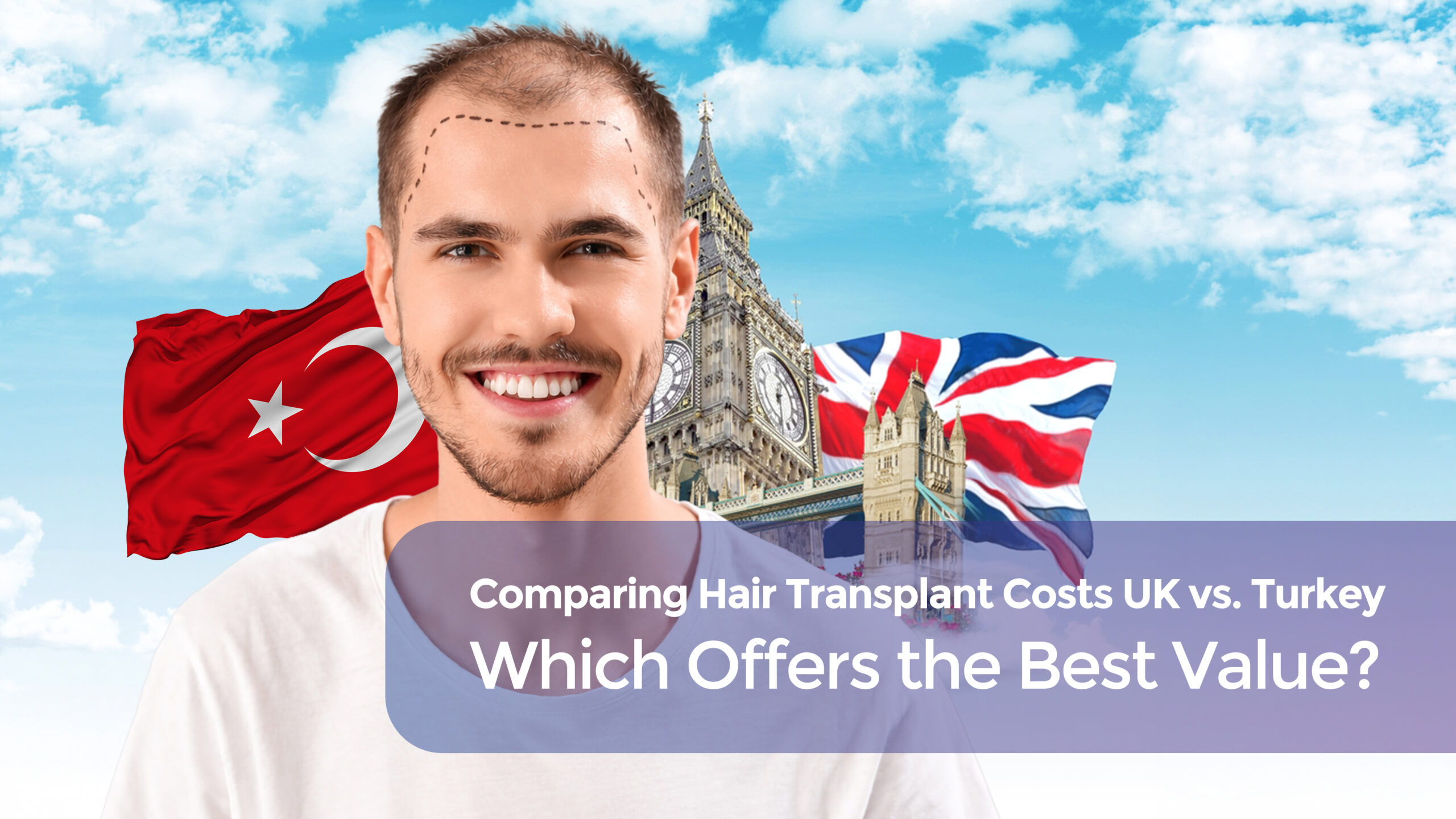 Hair Transplant cost UK cover