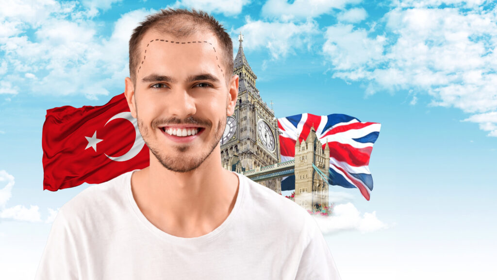 hair transplant in the UK