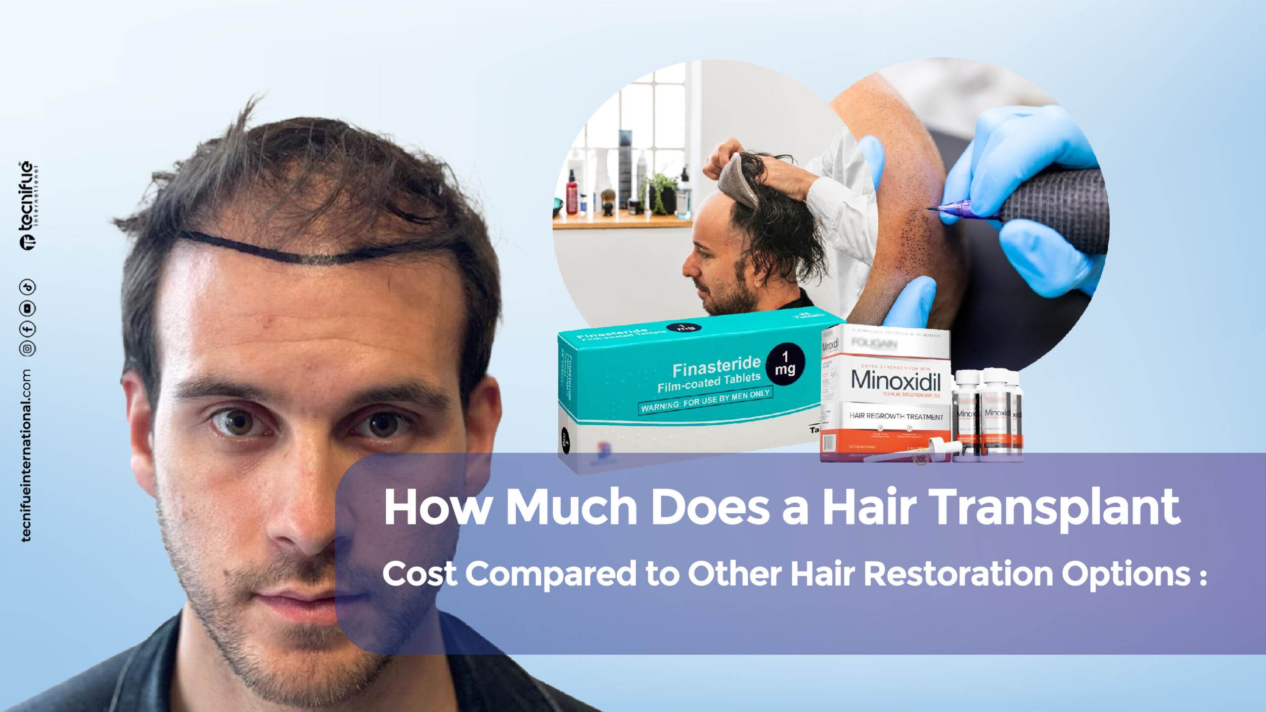 How much does a hair transplant cost cover