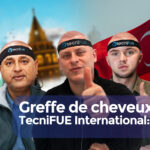 Greffe de cheveux chez TecniFUE cover