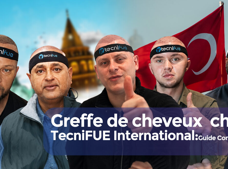 Greffe de cheveux chez TecniFUE cover