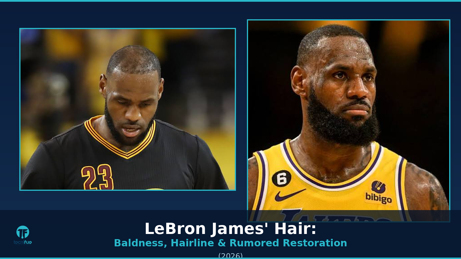 LeBron James Hair Transplant cover
